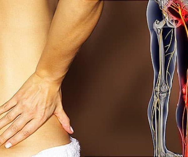 650x350_sciatica_overview_slideshow
