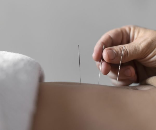 close-up-hand-holding-acupuncture-needle (1)